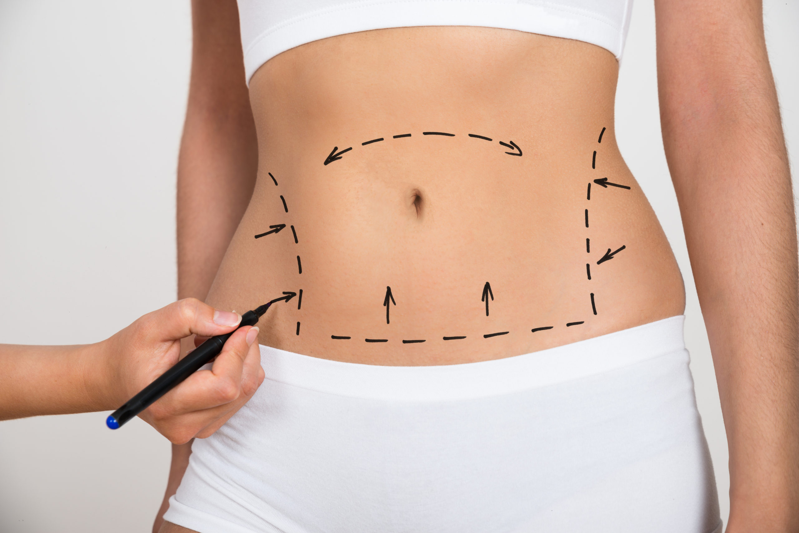 Liposuction in Dubai: A Look at Advanced Techniques and Transformative Results